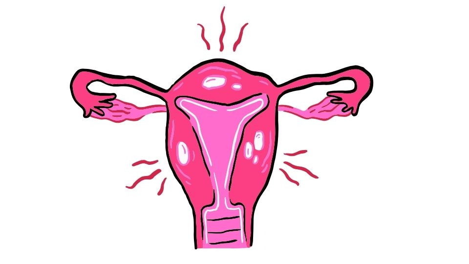 pcos
